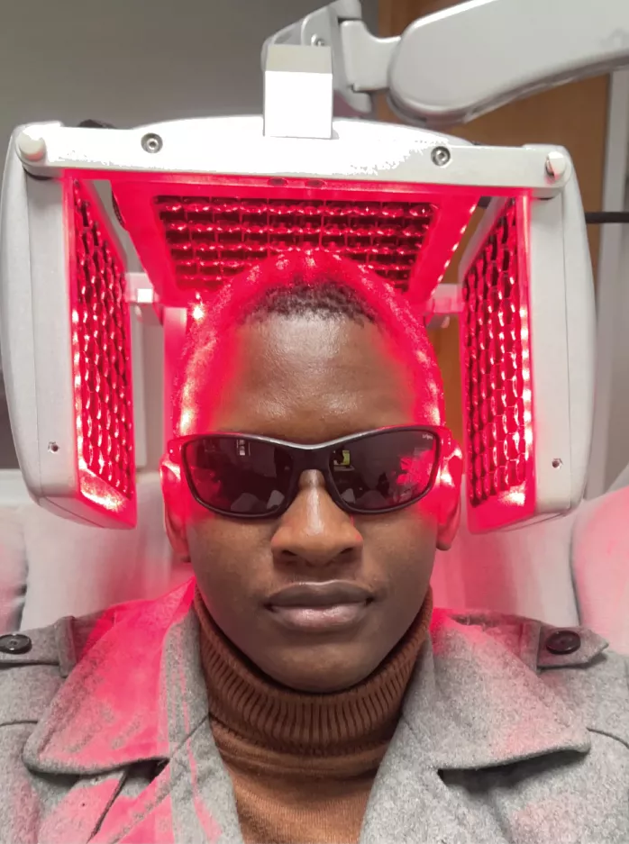 Low level laser therapy treatment for hair loss at Grace Follicles