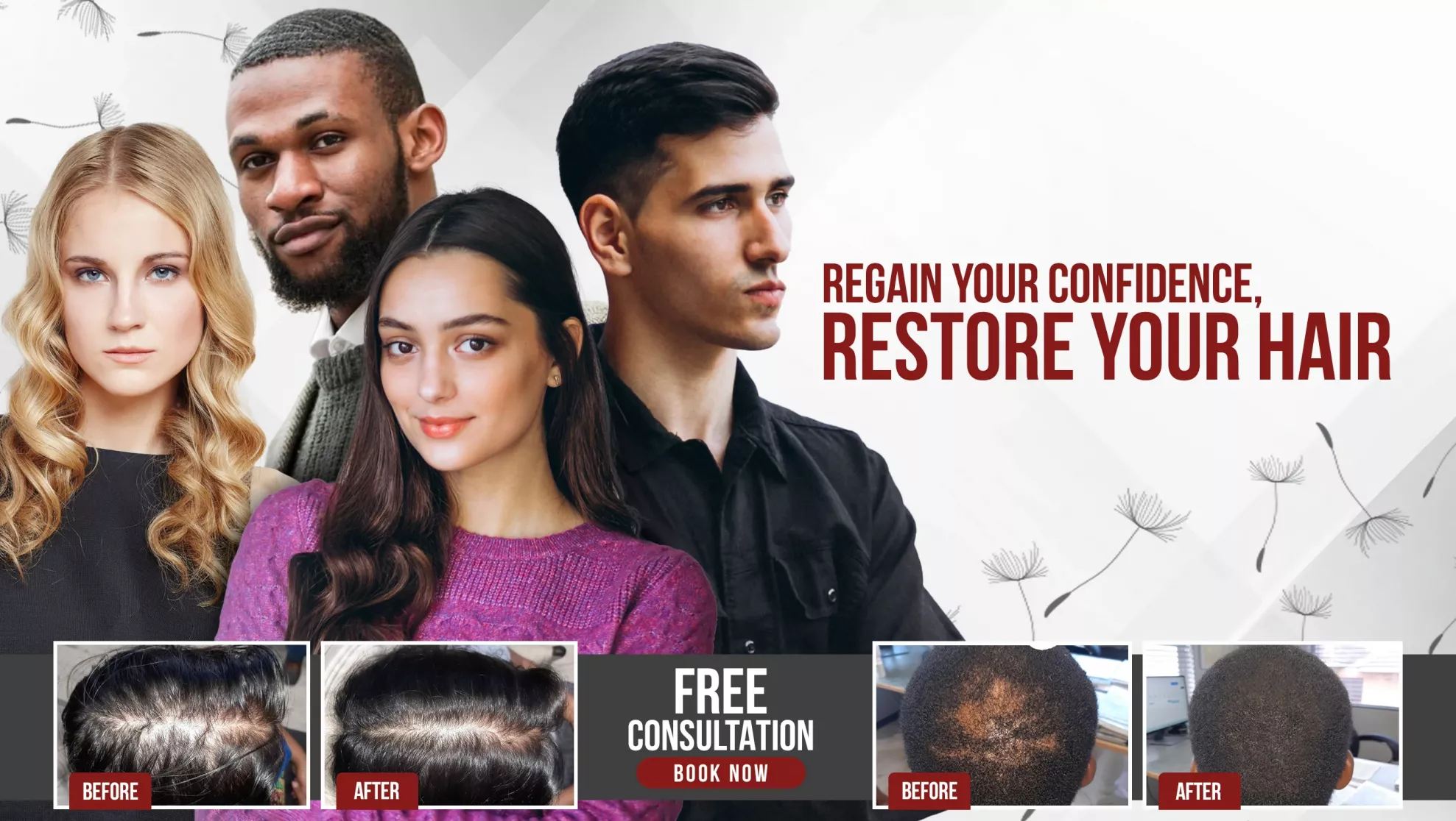 Hair restoration clinic banner Grace Follicles Durban Umhlanga Johannesburg Sandton before and after hair loss treatment results for men and women regrow hair regain confidence
